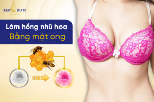 Có nên làm hồng nhũ hoa bằng mật ong tại nhà hay không?