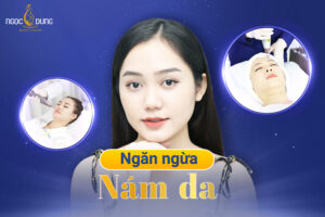 ngăn ngừa nám da