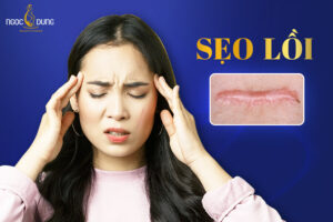 Sẹo lồi: Nguyên nhân, dấu hiệu và 11 cách trị sẹo lồi hiệu quả