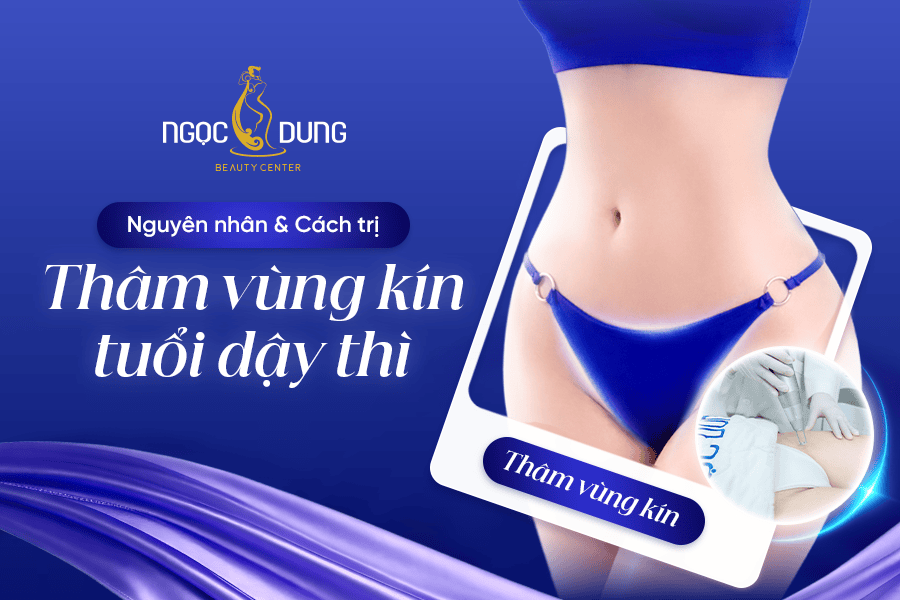 T1 SEO THAM VUNG KIN TUOI DAY THI