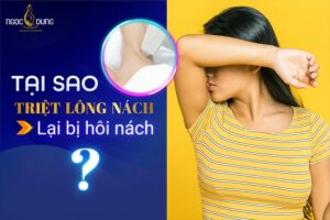 tại sao triệt lông nách lại bị hôi nách