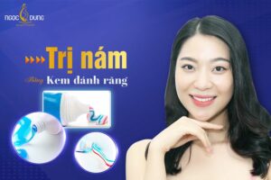 Trị nám bằng kem đánh răng