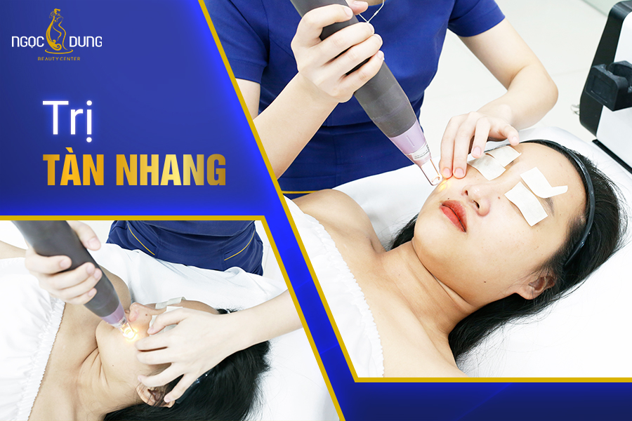 Trị tàn nhang tại nhà có được không? Trị tàn nhang tại nhà có được không?