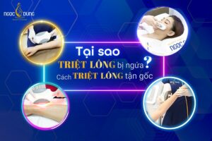 Triệt lông bị ngứa