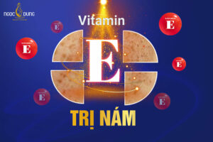 Vitamin E trị nám được không? 13 cách trị nám bằng vitamin E