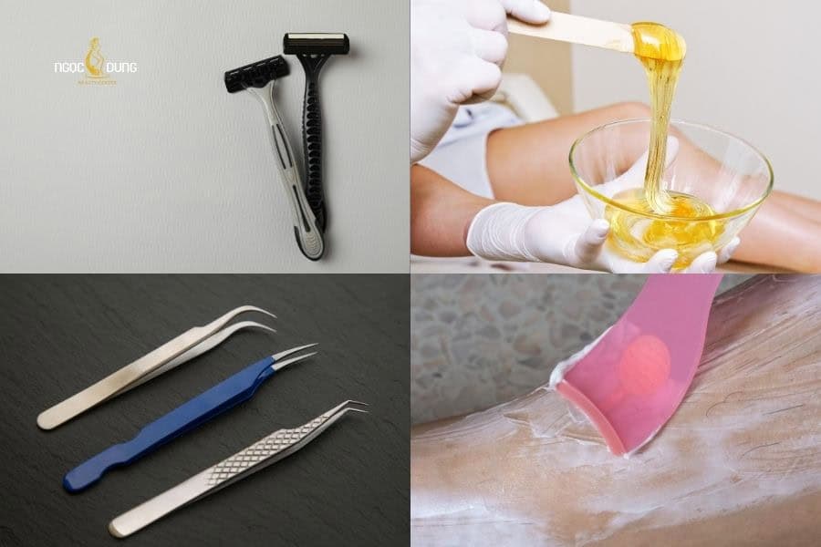Các phương pháo triệt lông kín nam an toàn tại nhà