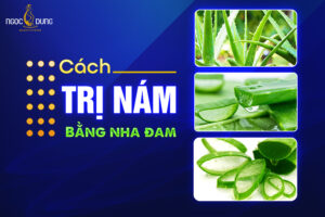 cách trị nám bằng nha đam