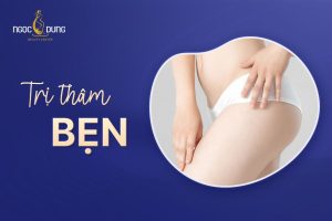Tổng hợp những cách trị thâm bẹn hiệu quả, đơn giản tại nhà
