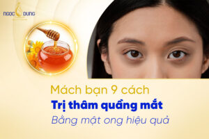 Mách bạn 9 cách trị thâm quầng mắt bằng mật ong hiệu quả