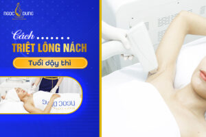 Cách triệt lông nách tuổi dậy thì
