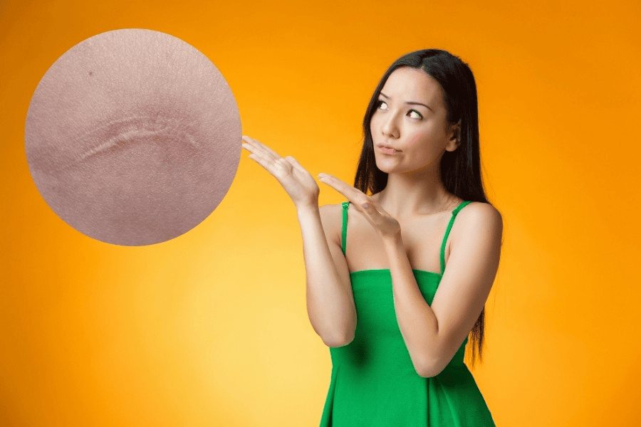 Cần nhận biết và xử lý sớm các vết thương để tránh hình thành sẹo lồi trên da