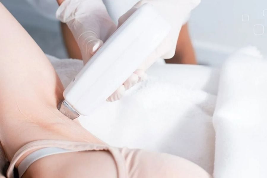 Sử dụng công nghệ IPL triệt lông​ cần đúng kỹ thuật để có hiệu quả tốt nhất