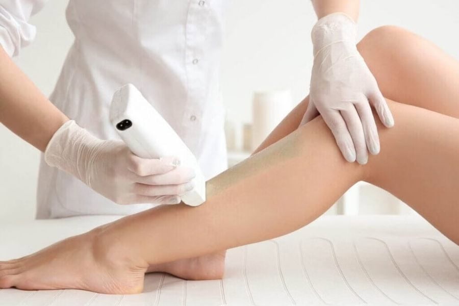 Công nghệ triệt lông IPL có chi phí tiết kiệm hơn nhưng cần thực hiện nhiều buổi điều trị hơn