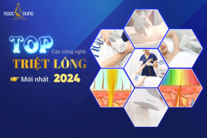 công nghệ triệt lông mới nhất