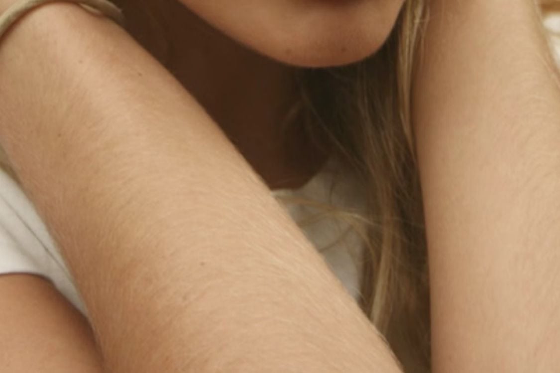 Loại da và màu lông cũng quyết định câu trả lời cho thắc mắc mỗi lần triệt lông cách nhau bao lâu​