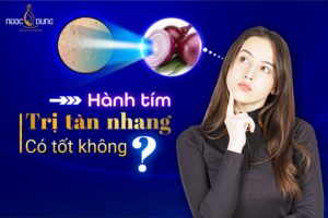 Mách nhỏ cho chị em các cách sử dụng hành tím trị tàn nhang đơn giản, dễ dàng thực hiện