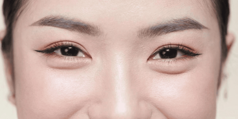 Hiểu rõ vì sao thâm mắt để có phương pháp điều trị phù hợp 