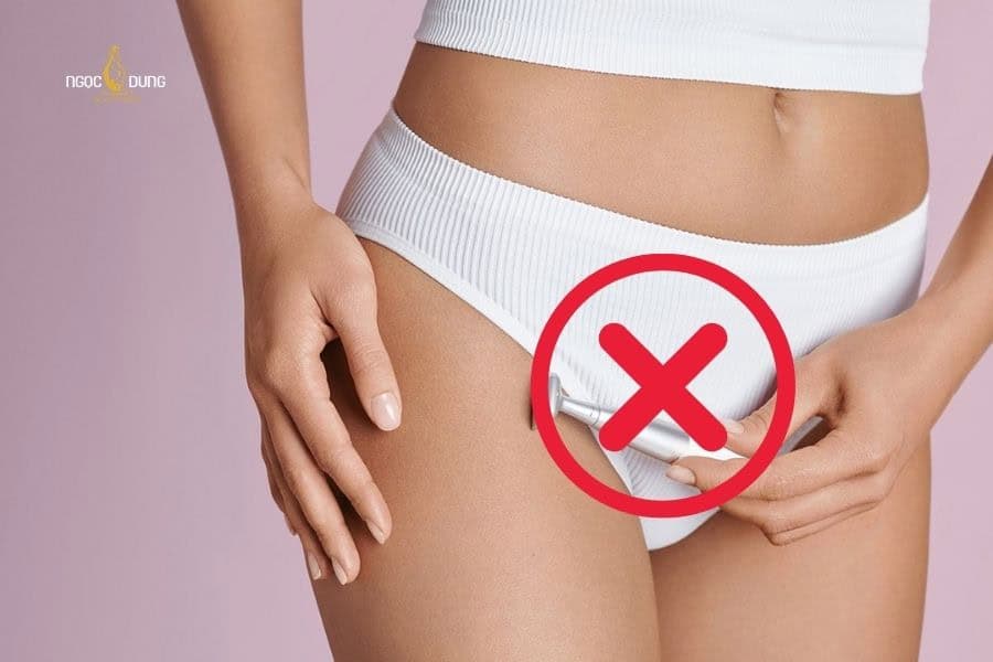 Tránh cạo hoặc tẩy lông trước khi triệt lông tạo hình bikini​