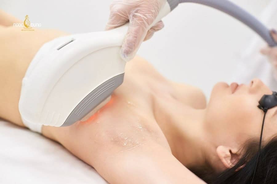 Người thực hiện nên tuân thủ khoảng cách giữa các buổi triệt theo liệu trình đã được tư vấn
