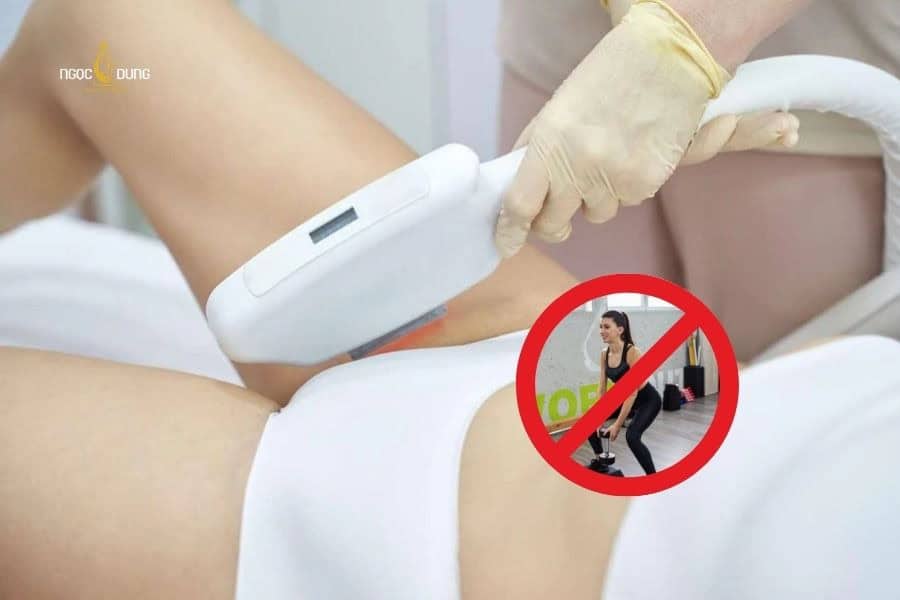 Hạn chế vận động mạnh sau khi triệt bikini tạo hình