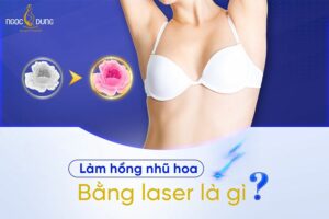 Làm hồng nhũ hoa bằng laser