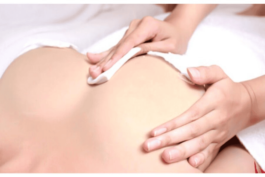 Làm hồng nhũ hoa bằng peel kết hợp với laser sẽ giúp giảm nguy cơ thâm quay lại 