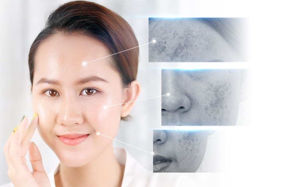 Thải độc da mặt là gì? Bí quyết detox da sáng mịn màng 8 Liệu trình hút chì thải độc da mặt với trang thiết bị hiện đại bậc nhất