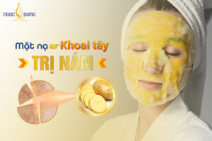 Trị nám bằng khoai tây có hiệu quả không?