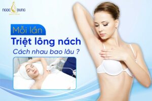 mỗi lần triệt lông nách cách nhau bao lâu