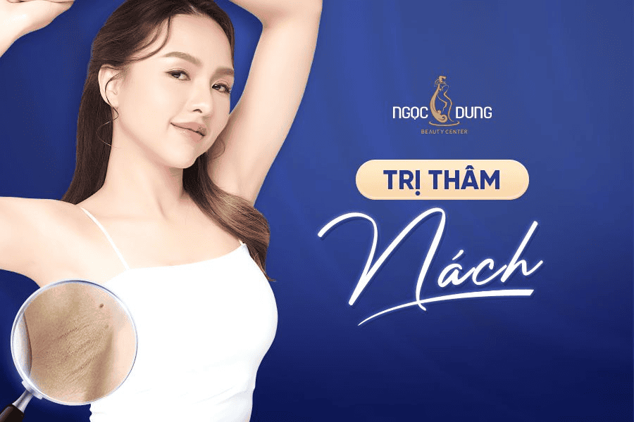 Nên trị thâm nách tại nhà hay bằng laser?