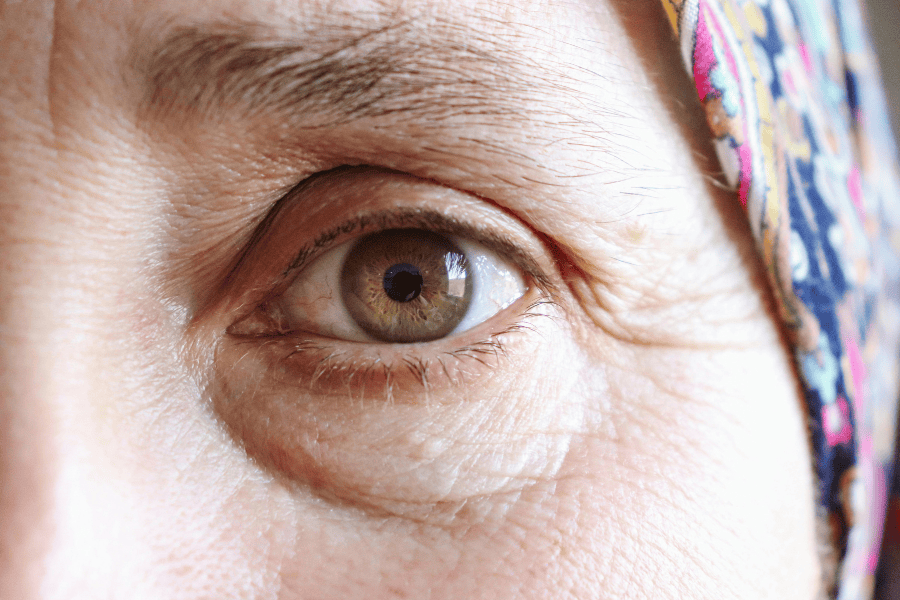 Những cách xóa nếp nhăn vùng mắt hiệu quả hiện nay