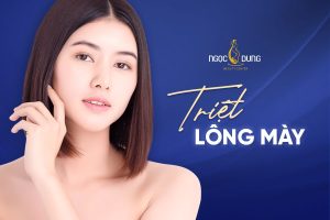 Có nên triệt lông mày thừa không?