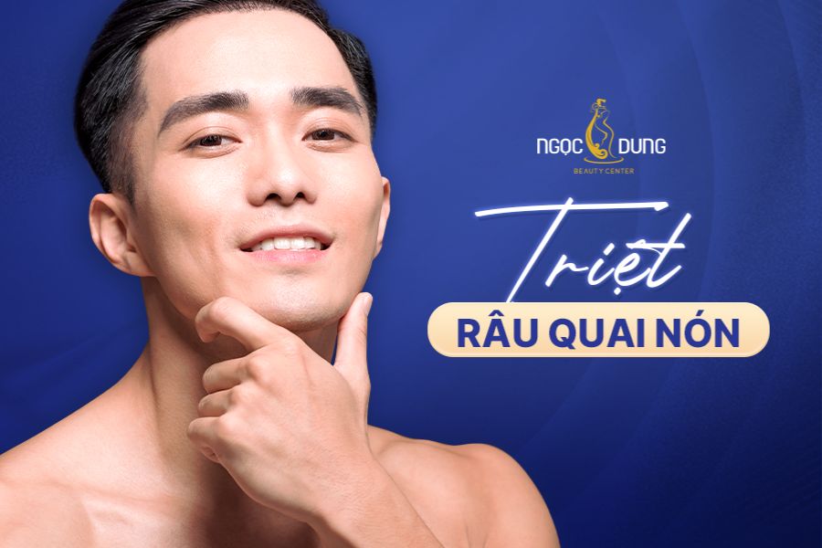 Tổng hợp những cách triệt râu quai nón hiệu quả