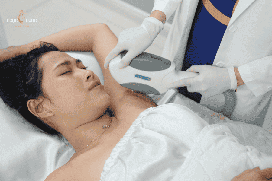 Picosure Pro là thế hệ laser trị thâm tiên tiến nhất hiện nay, được áp dụng tại TMV Ngọc Dung