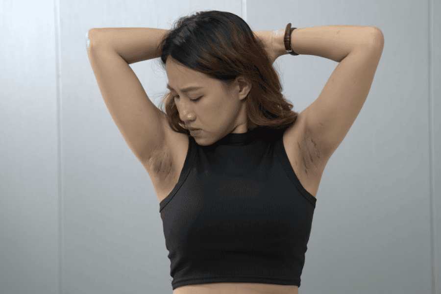 Sự thay đổi nội tiết tố đột ngột khiến nách bị thâm 
