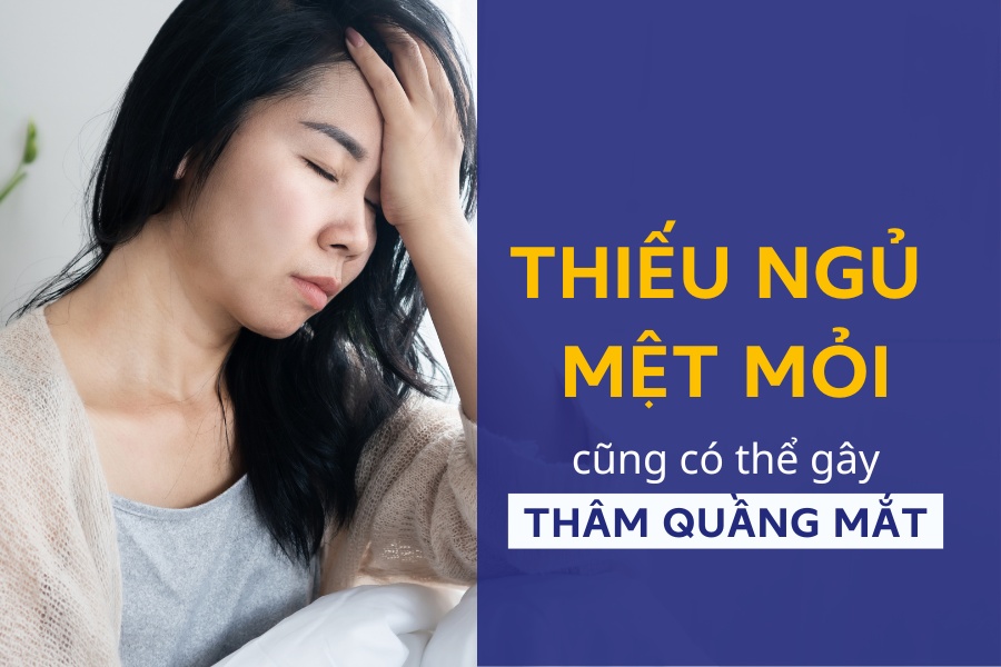 thâm mắt do thiếu ngủ