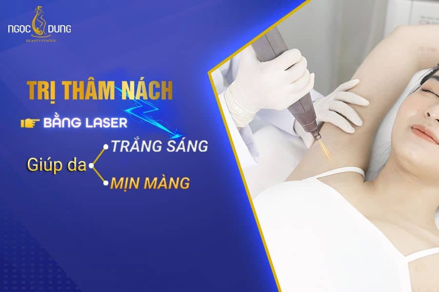 Trị thâm nách bằng laser có hiệu quả không?