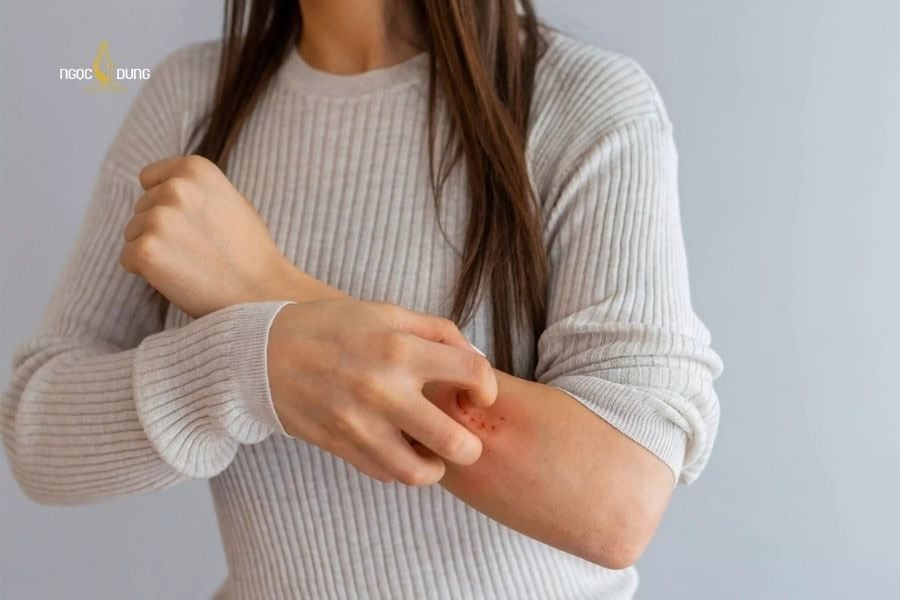 Triệt lông bị ngứa là hiện tượng khá phổ biến