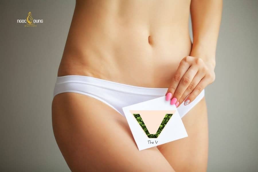 Triệt lông vùng bikini tạo hình​ chữ V phù hợp với người thích phong cách hiện đại 