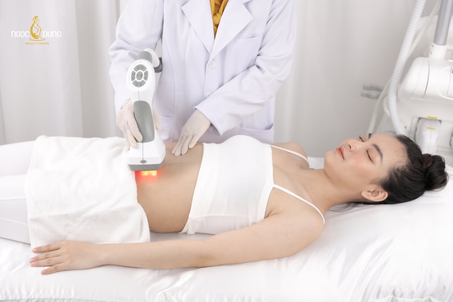 Triệt lông bụng giúp lông mọc chậm, thưa hơn tùy vào cơ địa của mỗi người