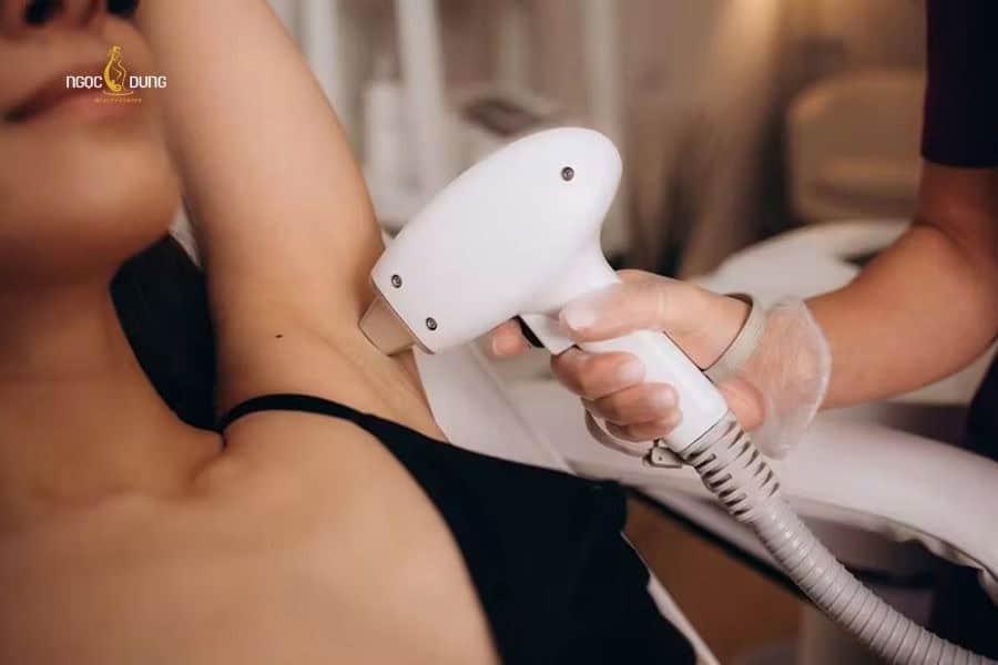 Cách triệt lông vĩnh viễn không mọc lại an toàn và hiệu quả 5 Triệt lông IPL hoạt động dựa trên sóng ánh sáng phổ rộng