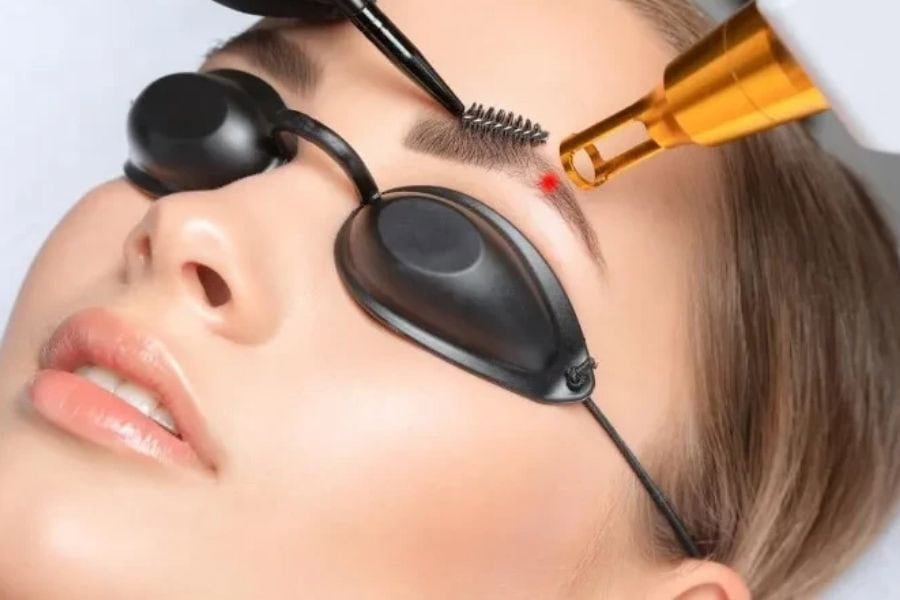 Triệt lông mày hiệu quả: Phương pháp và chi phí cần biết 9 Diode Laser là công nghệ cải tiến vượt trội trong lĩnh vực triệt lông mày