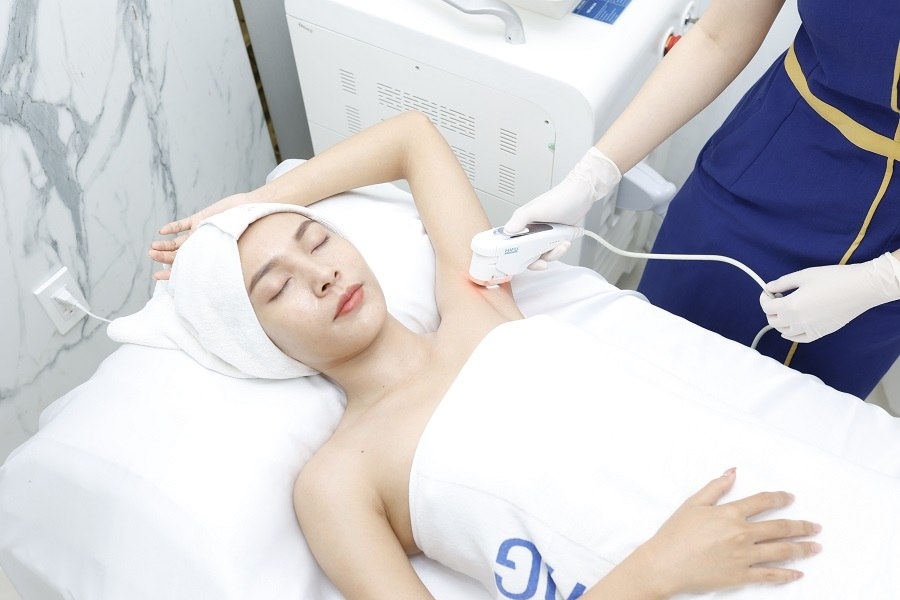 Quy trình triệt lông nách chuẩn y khoa