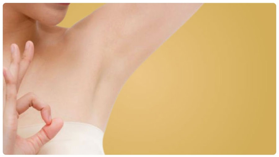 Triệt lông nách bằng tia laser là gì? Có hiệu quả không? 9 Hiệu quả triệt lông nách phụ thuộc vào công nghệ và quy trình thực hiện