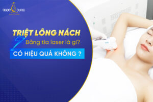 triet long nach bang tia laser