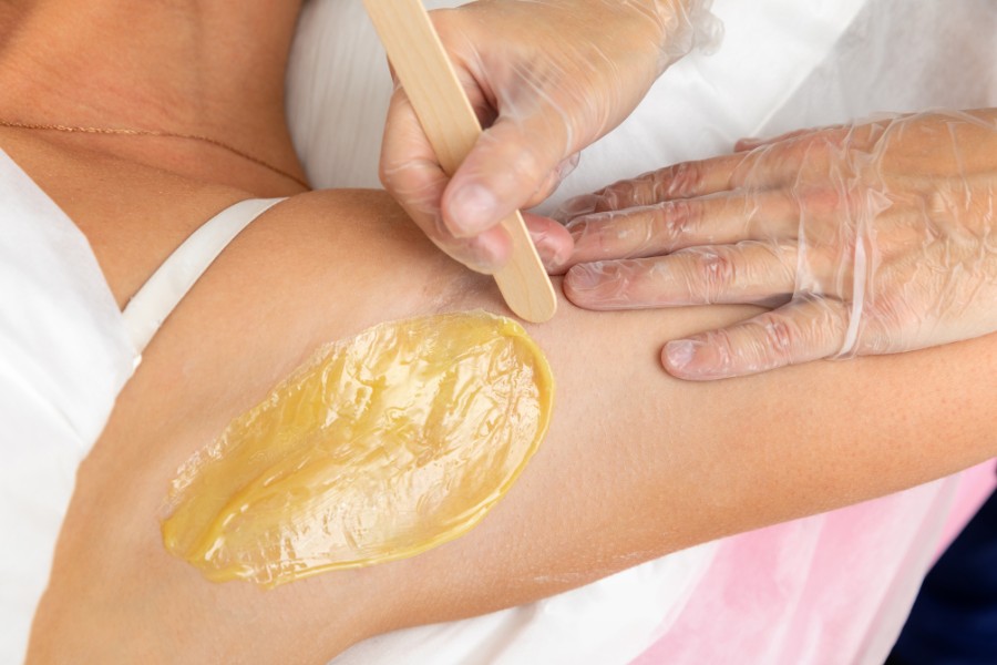 Việc sử dụng sáp wax lông thường kèm theo cảm giác nhức nhối, sưng đỏ trên da Việc sử dụng sáp wax lông thường kèm theo cảm giác nhức nhối, sưng đỏ trên da