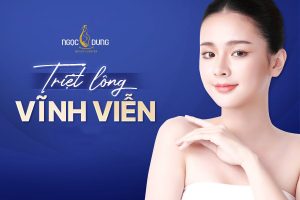 Triệt Lông Vĩnh Viễn: Bí Quyết Sở Hữu Làn Da Mịn Màng 2025