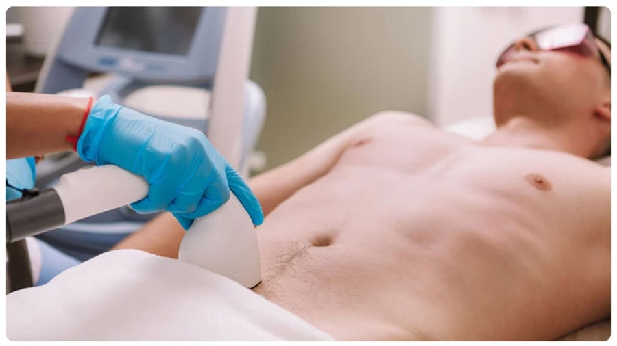 Nên chọn những Thẩm mỹ viện uy tín khi triệt lông vùng bikini