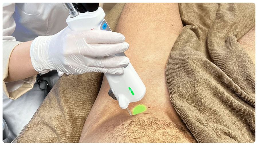 Công nghệ là yếu tố quyết định phần lớn đến chi phí triệt lông