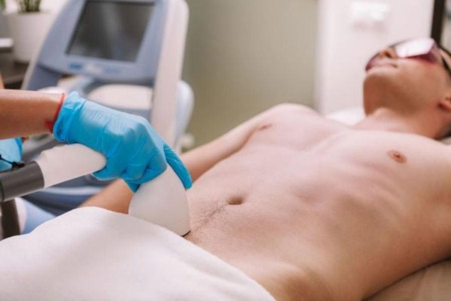 Triệt lông giúp giảm mật độ lông dày – yếu tố dễ giữ lại mồ hôi và vi khuẩn
